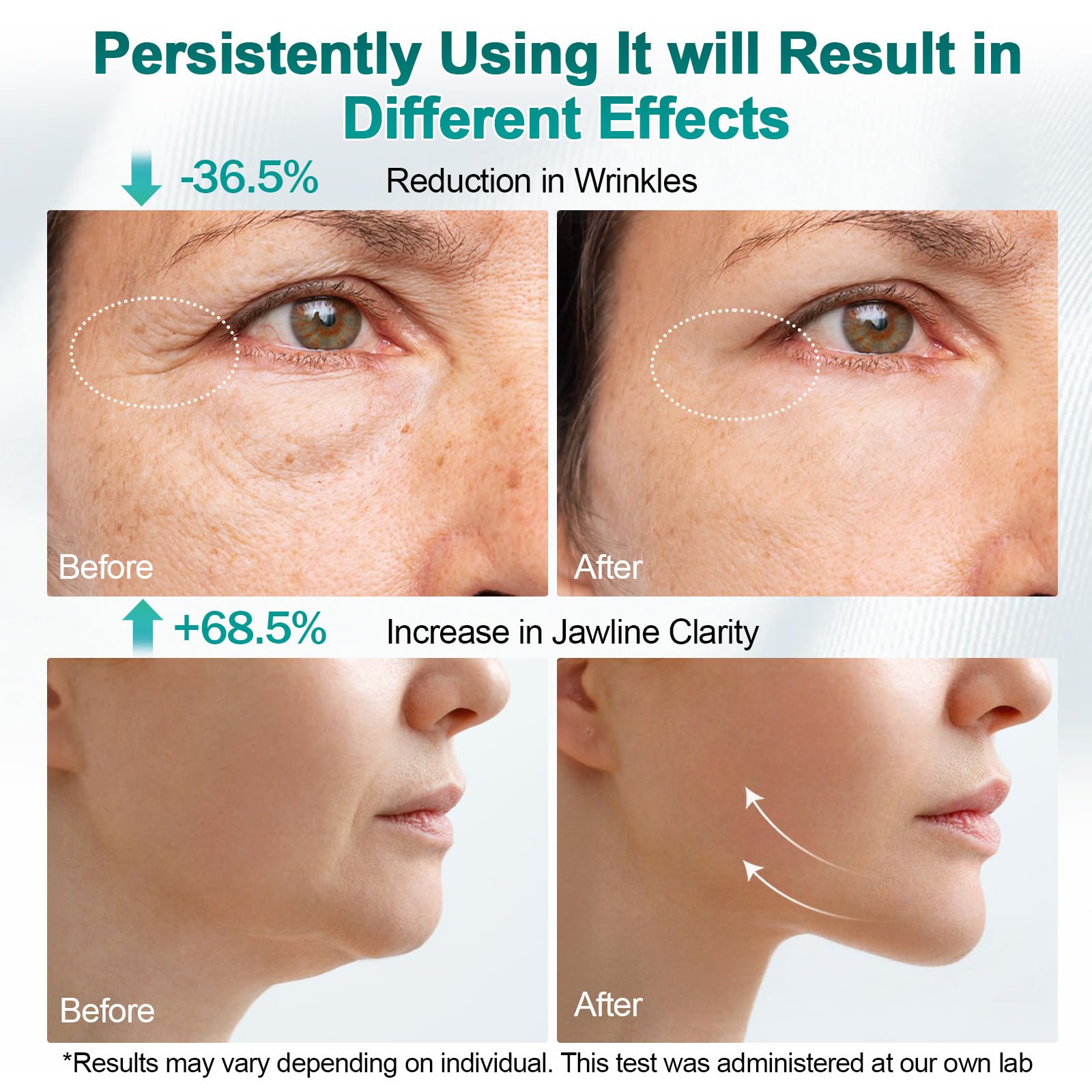 4 IN1 Radiofrequenza Viso e Corpo Professionale, 40K Massaggiatore Anticellulite Radiofrequenza Corpo Rassodanti e Tonificanti per il Anticellulite Macchinario