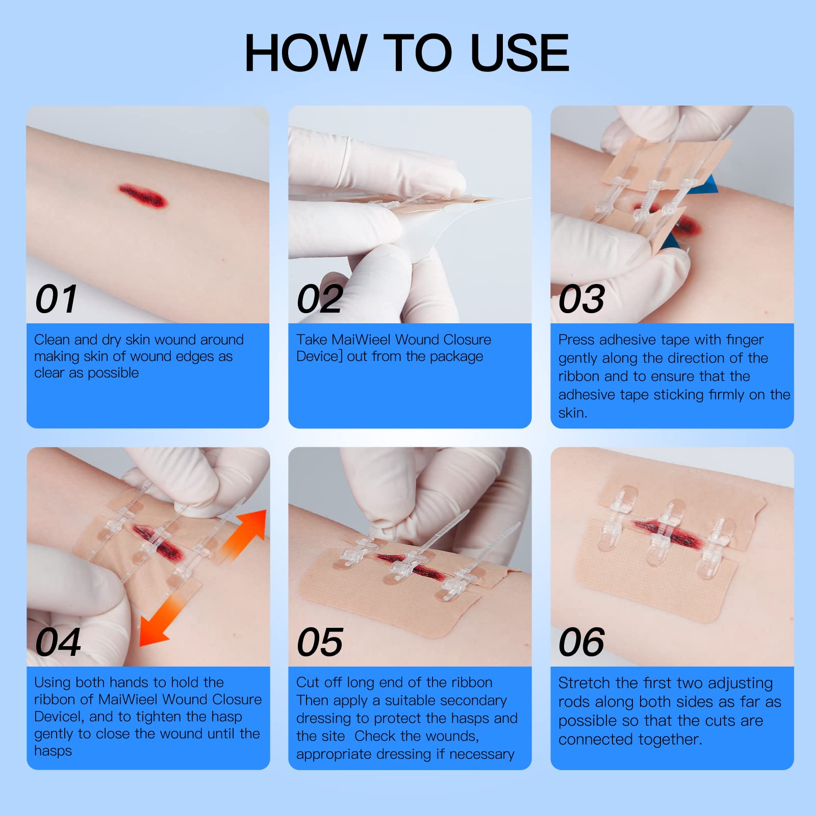 Improvised Ways to Close a Wound