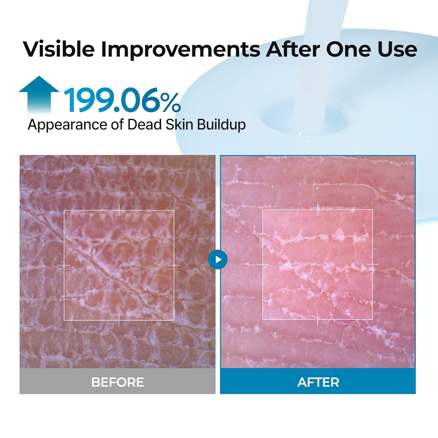 Dr.Melaxin TX Peel Shot Body Exfoliating Spray with Tranexamic Acid & Niacinamide, Brightening Body Care for Uneven Skin Tone, 200ml - Image 5