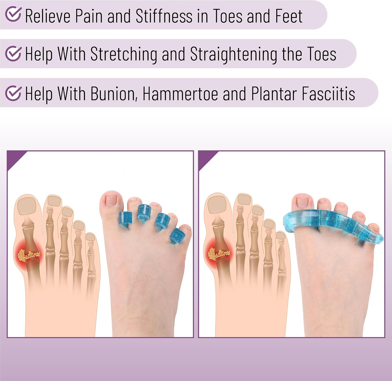 DR JK- ToePal Gel Toe Separator, 4 Pairs, Blue, Toe Spacers, Bunion Corrector