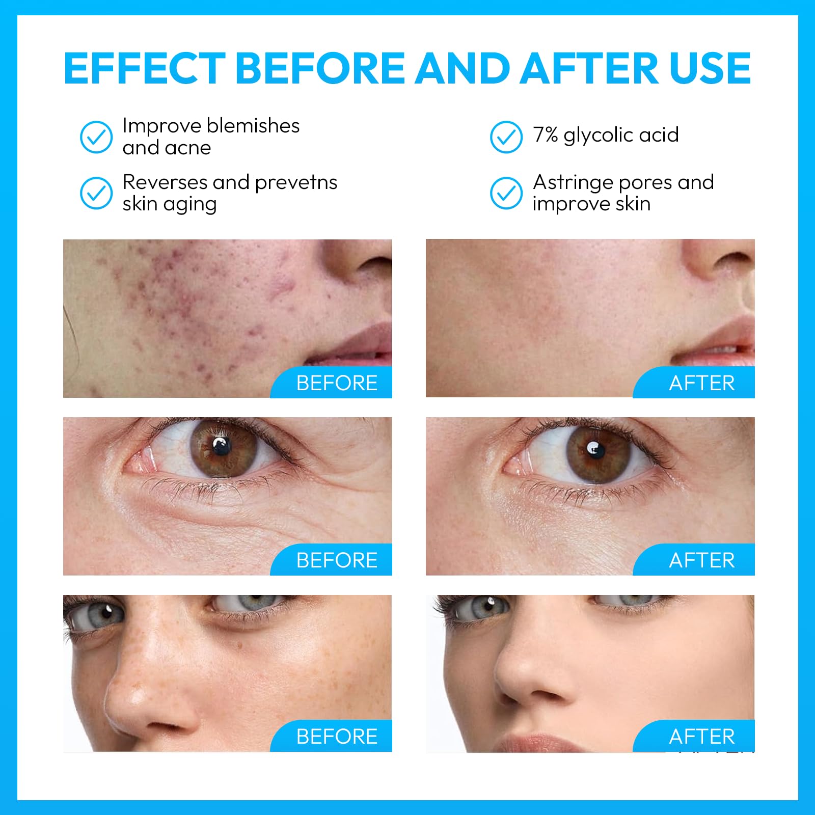Acido glicolico - 60 gr - 70% Soluzione esfoliante AHA ad alta potenza | Formula per un profondo rinnovamento della pelle e una texture più definita | A base d'acqua