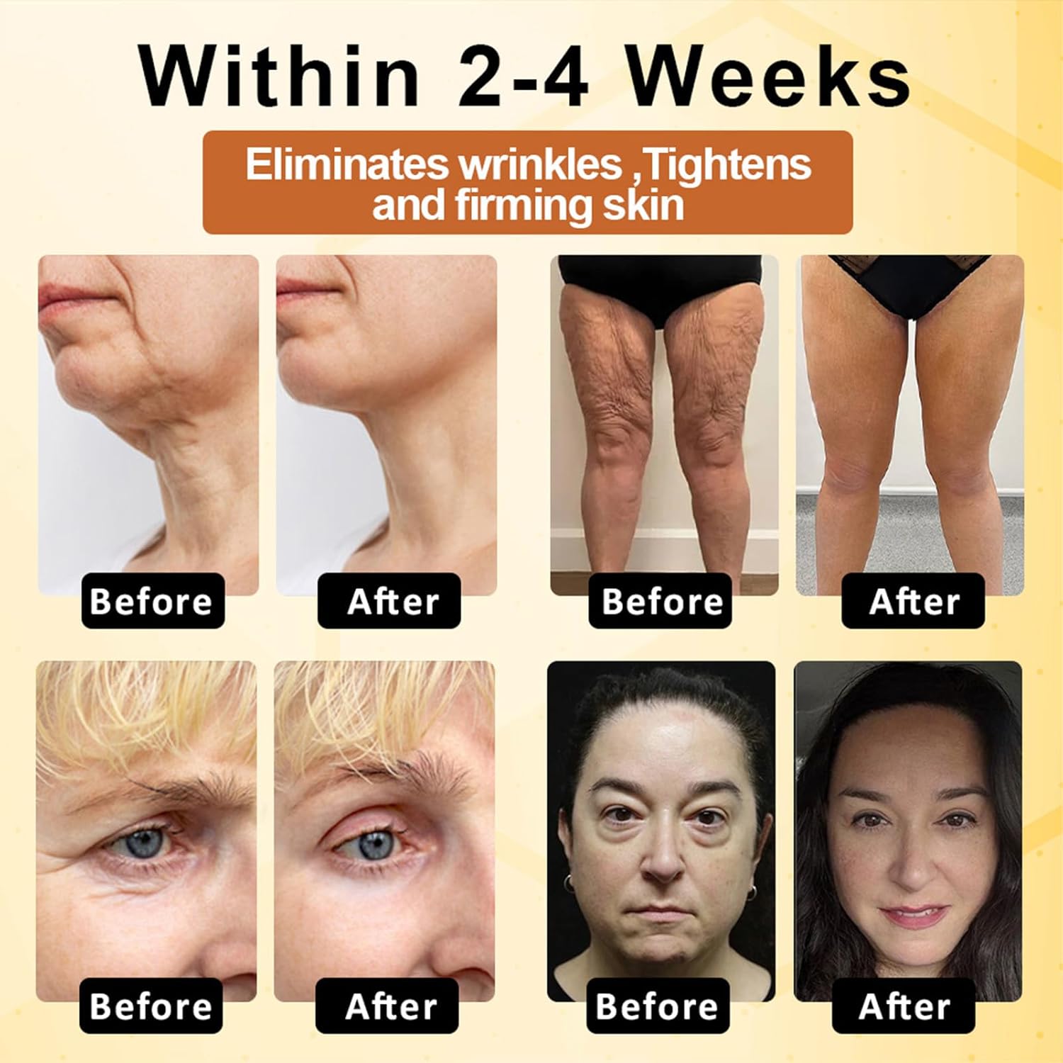 ApisDerm Firming Cream, Advanced Multi-Action Firming Cream, Bee Venom Wrinkle Removal cream, Advanced firming & Wrinkle-Reducing, bee venom for Tightens Skin (4)