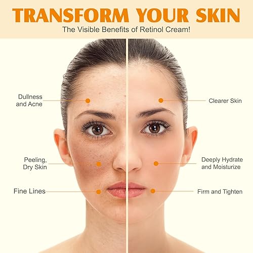 Miniatura 8 de Sargo de ternera para la piel, sebo de ternera y bálsamo de miel, sebo de res para la cara, cuidado de la piel de ternera, crema hidratante facial