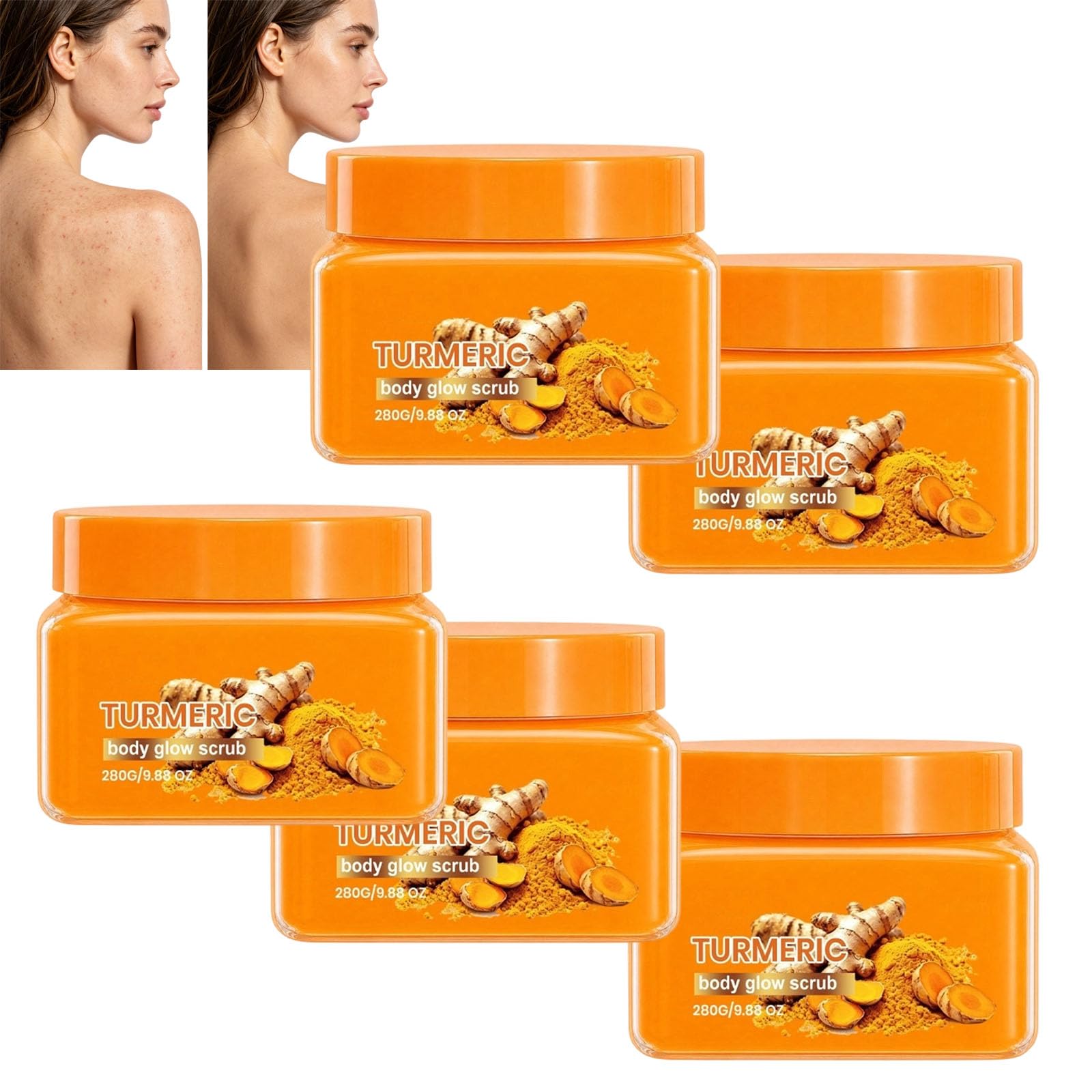 Scrub Corporale Esfoliante Con Curcuma, Scrub Idratante Ed Esfoliante, Scrub Per La Pelle Liscia E Ferma - Scrub Esfoliante Per Il Corpo, Idratare, Alleggerire, Lenire E Uniformizzare (5Pz)