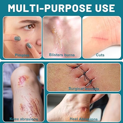 Miniatura 3 de WUYUAN Rollo hidrocoloide para el cuidado de heridas, elegible para HSA FSA, vendajes hidrocoloides con vendajes autoadhesivos, extra grandes de