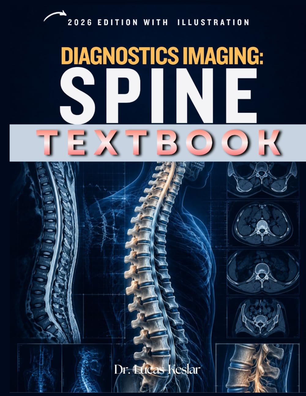 DIAGNOSTIC IMAGIN: Spine: A Practical Guide to Spine Anatomy, Pathology, Imaging Protocols, Differential Diagnosis, Case-Based Learning, Review Questions, and Reporting Essentials