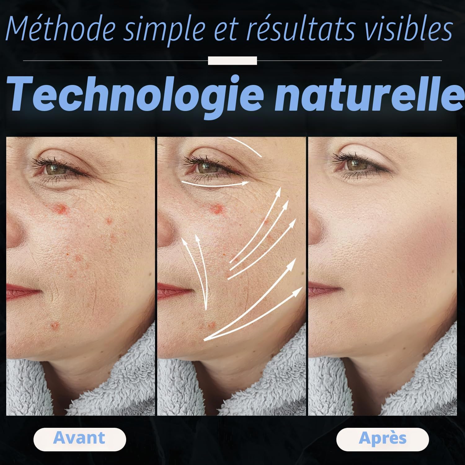 UUPAS 4 en 1 Bleu Appareil Haute Frequence Esthetique - Haute Frequence Visage Baguette avec 4 Tubes - Machine de Resserrement de la Peau pour l'acné, l'élimination des Rides,le Rajeunissement