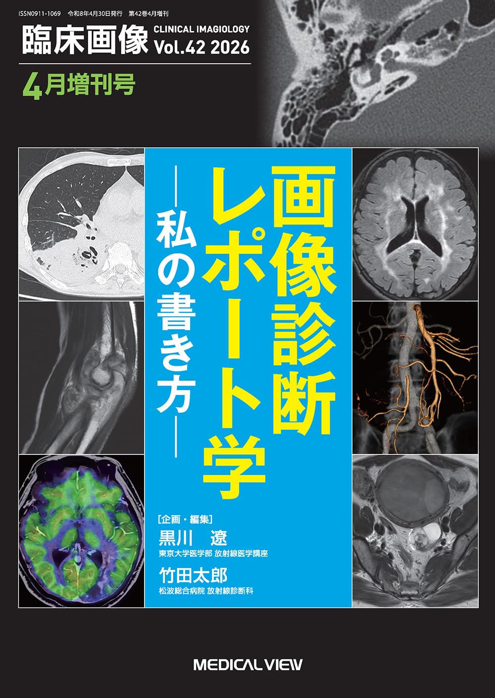 臨床画像 2026年4月増刊号 特集：画像診断レポート学-私の書き方