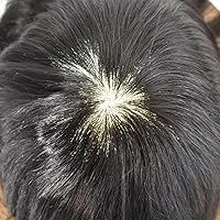 Vista 3 de Toupee - Pieza de cabello humano para hombre, sistema de reemplazo de cabello, piezas de pelo de poliuretano para hombres, tupé, protesis capilar