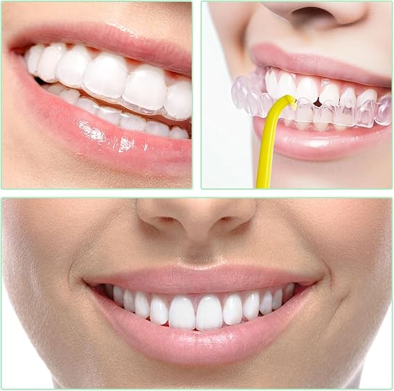 Clear Aligner Removal Tool,30 Pcs Retainer Remover Tool,Invisible Braces Removal Tool,Chewies Remover Tool,Braces Remover Hook for Tooth Cleaning Oral Care(5 Colors)