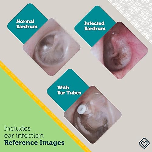 Miniatura 5 de Safety 1st Otoscopio de oído, gris