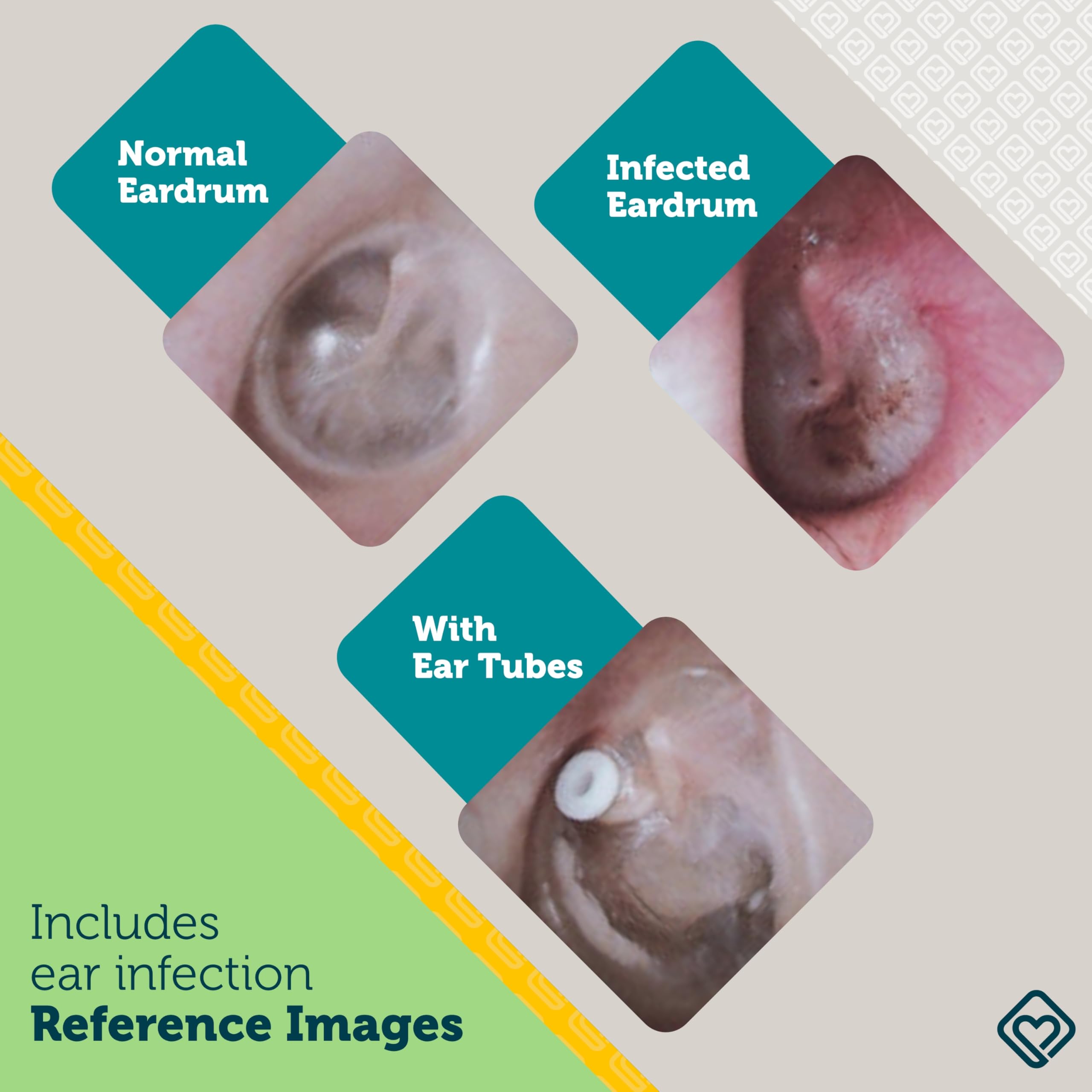 Safety 1st Ear Otoscope - Check for Ear Infections -5 Safety 1st Ear Otoscope - Check for Ear Infections -5