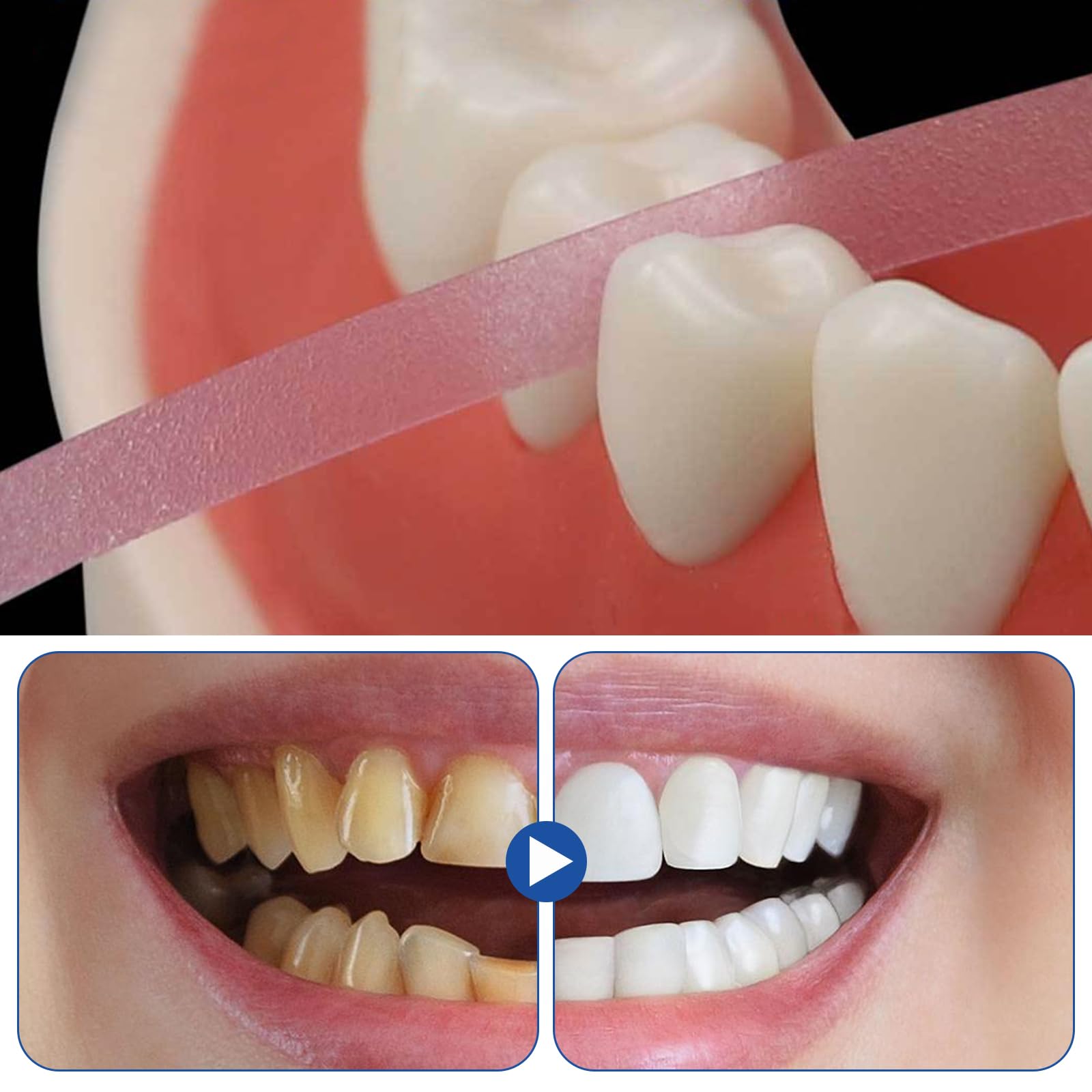 Papel de Lija Interdental Tiras de Lijado Dental 3 Volúmenes para Limpieza Bucal