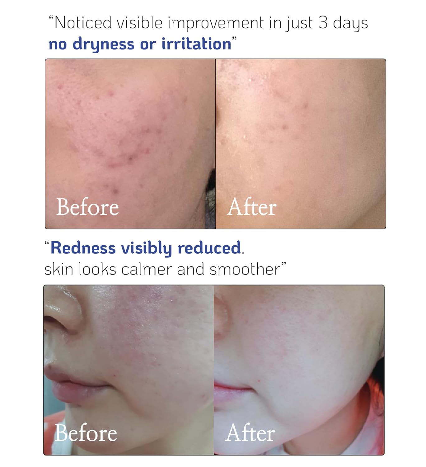 Versatile High-Potency Ceramide Concentrate Mix 1-2 Drops with Any Product Hydrating Moisturizer Enhancer Strengthening Skin Barrier 41ml - Image 4