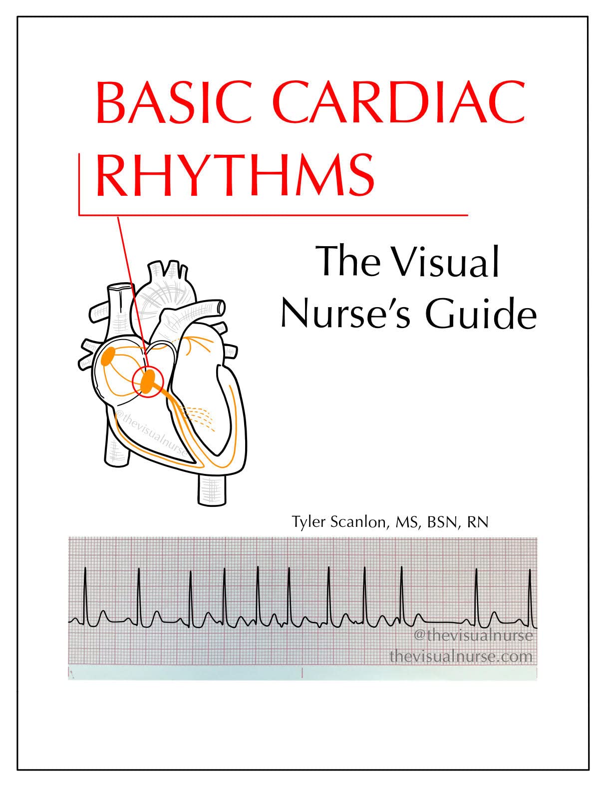 Basic Cardiac Rhythms: The Visual Nurse's Guide