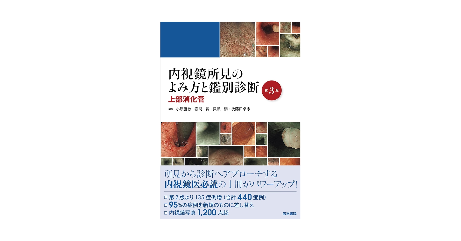 内視鏡所見のよみ方と鑑別診断 : 上部消化管 内視鏡所見のよみ方と鑑別診断 上部消化管 | 純治, 芳野, 実