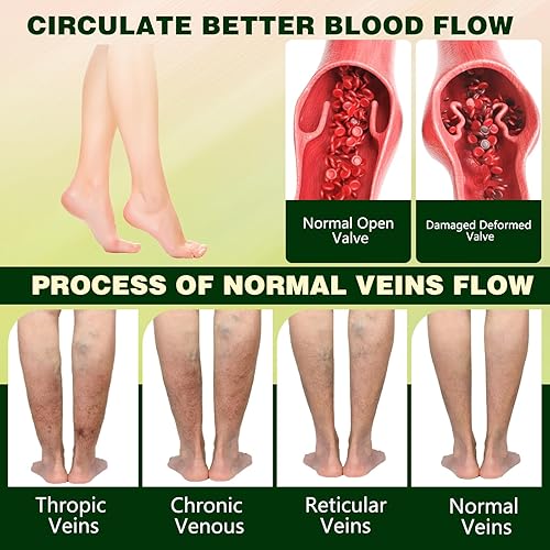 Miniatura 3 de FluidEase - Crema para el edema de piernas, bálsamo para piernas hinchadas, crema de terapia de piernas Fluid Ease para aliviar el edema de piernas