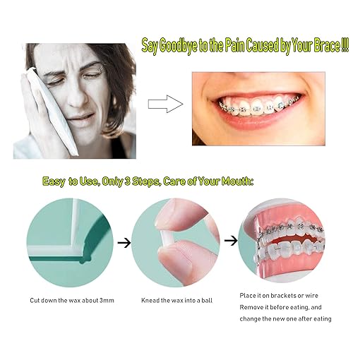 Miniatura 3 de Cera de ortodoncia para aparatos ortopédicos, paquete de 10 unidades de cera dental para aliviar la irritación y el dolor, sabor a menta azul