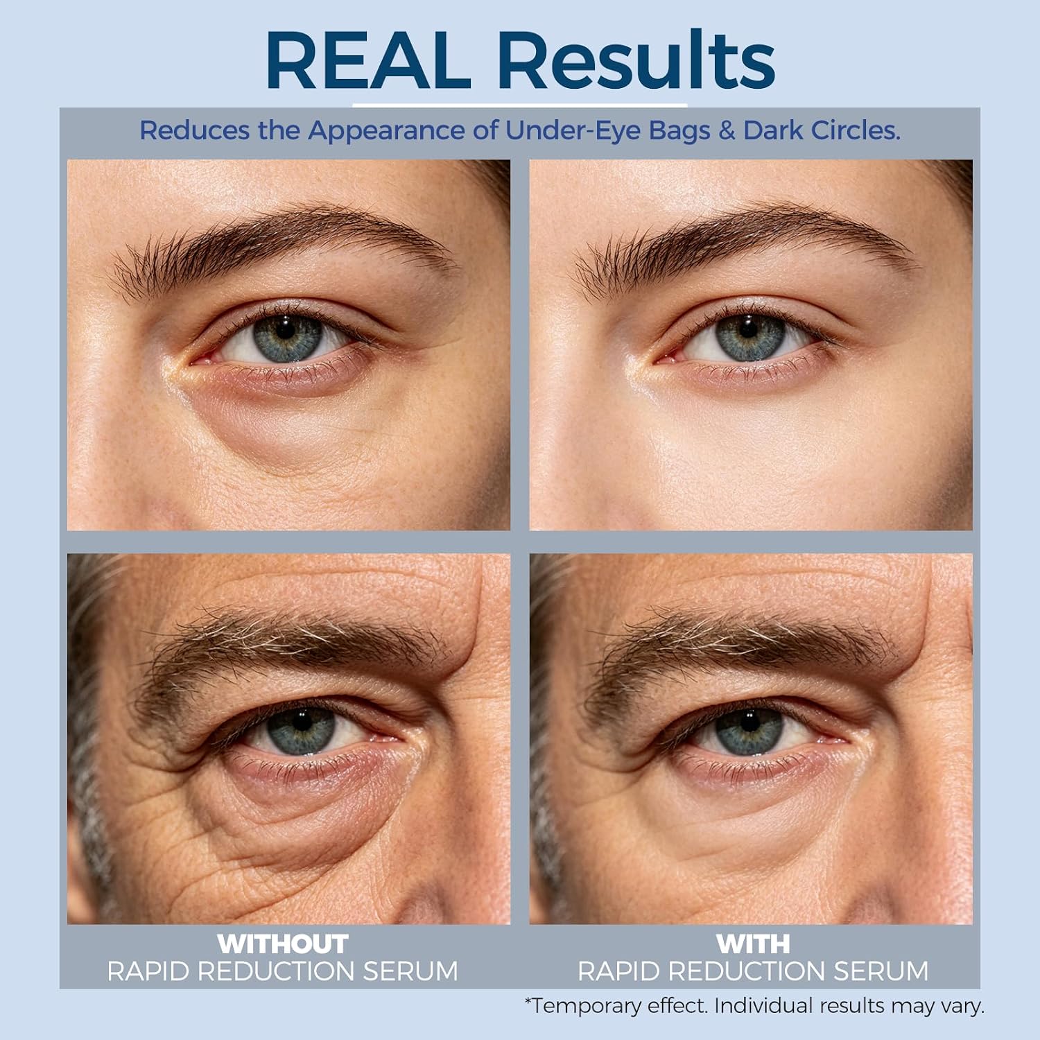Rapid Reduction Eye Serum - Visibly Reduces Under-Eye Bags, Wrinkles, Dark Circles, Fine Lines & Crow's Feet Instantly, Facial Serum-10ML