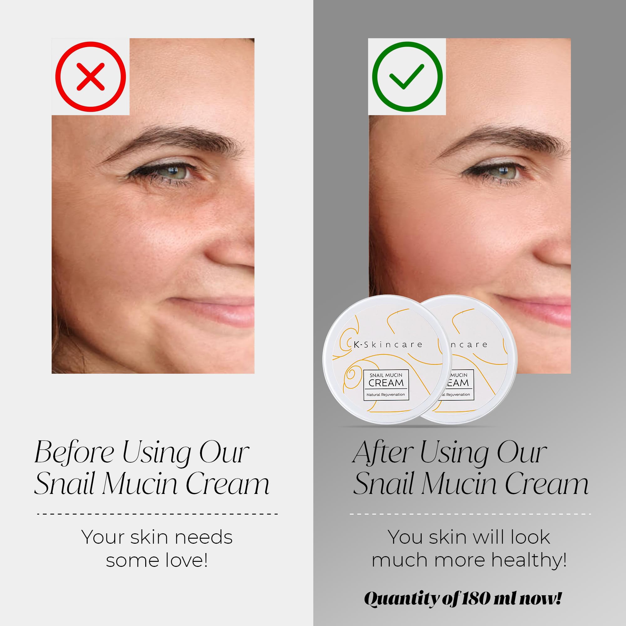 x2 Premium Snail Mucin Essence Cream with Hyaluronic Acid, Advanced Skin Repair, Deep Hydration - Image 2