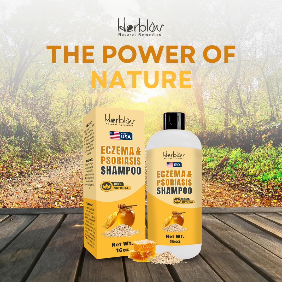 Eczema Shampoo – All-Natural Dermatitis & Psoriasis Treatment for Dry, Itchy, Flaky Skin – Daily Dandruff & Scalp Treatment – Itchy Scalp Relief for Men, Women & Kids – Eczema Soap Shampoo Made in USA - Image 8