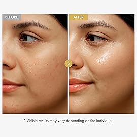 TOSOWOONG Glow Bean Face Cream, 63,844ppm Soybean Ferment Extract, Korean Skincare for Glass Skin, Moisturizer, Relief, Smooth, Nourished Skin, Anti-Aging, Hydrating, K Beauty, 50 ml / 1.69 fl. oz.