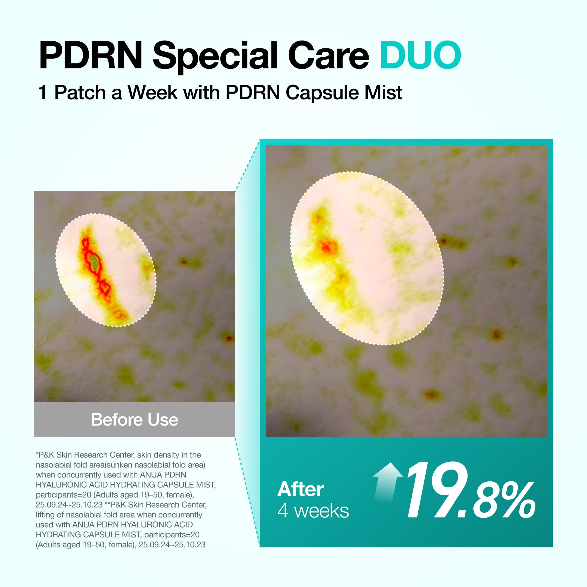 ANUA PDRN COLLAGEN MELTING PATCH FOR GLASS SKIN (0.05 g * 4 EA)