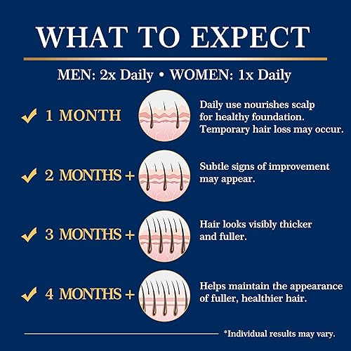 Miniatura 6 de Spray de minoxidil al 5% para hombres y mujeres, kit de crecimiento del cabello con biotina, tratamiento extra fuerte para la pérdida y