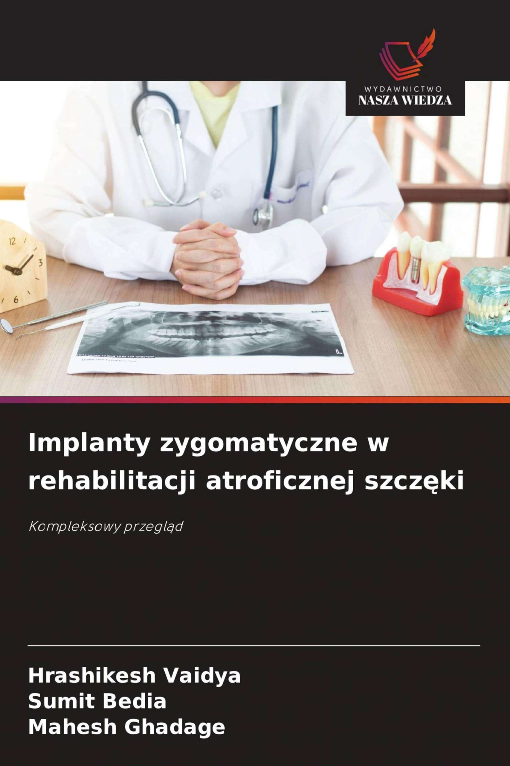 Implanty zygomatyczne w rehabilitacji atroficznej szcz¿ki: Kompleksowy przegl¿d