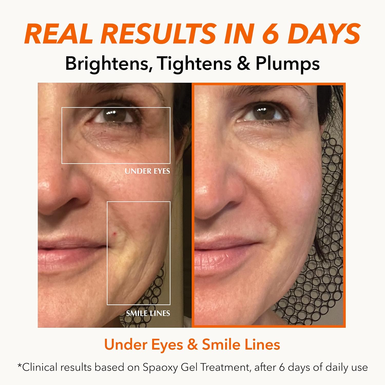 Dr. Medion Spaoxy Gel Advanced - Intensive Carbonated Skin Treatment Mask for Hydrated, Glowing Skin – Dermatologist Developed CO2 Therapy Mask, Made in Japan - Image 5