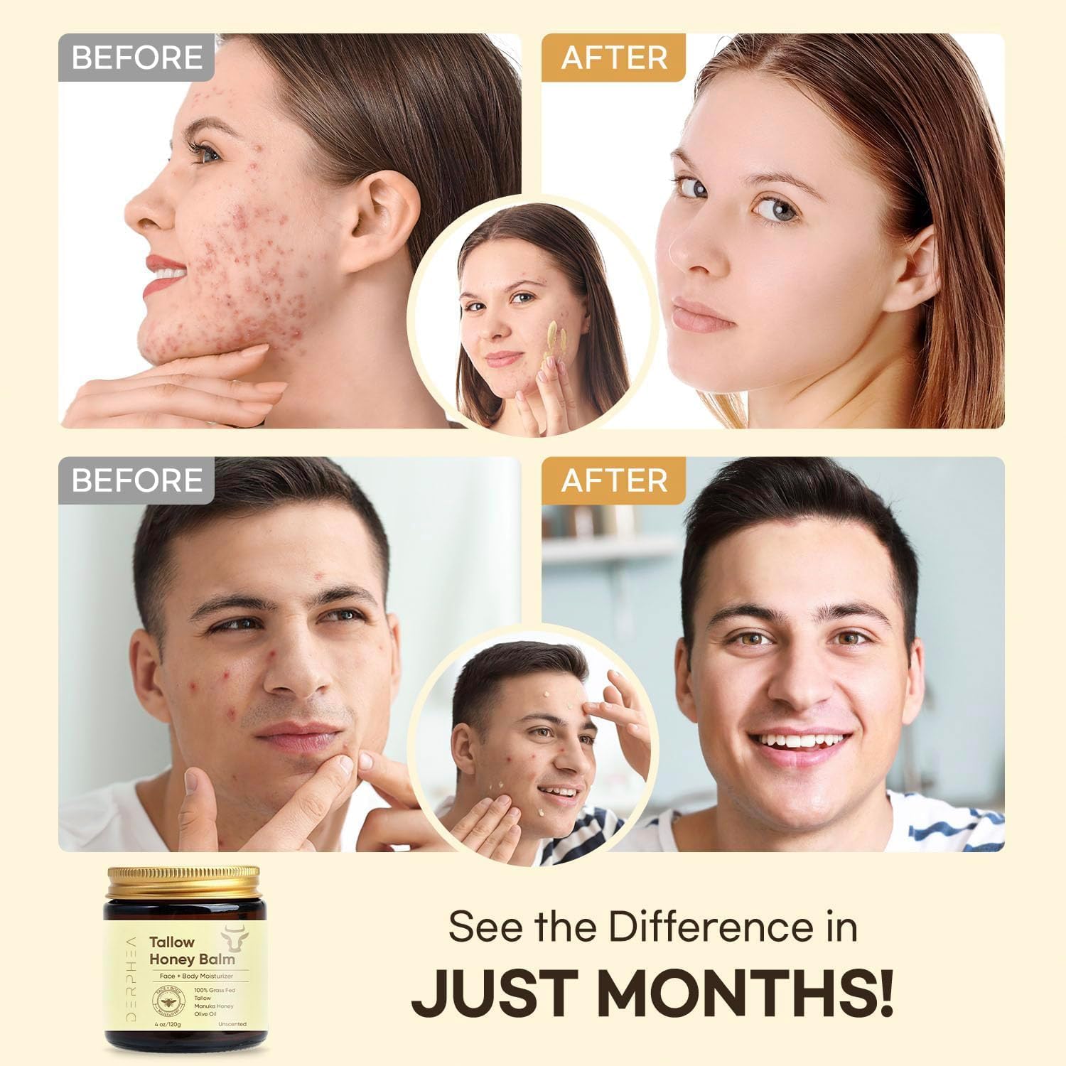 Beef Tallow Skincare Balm