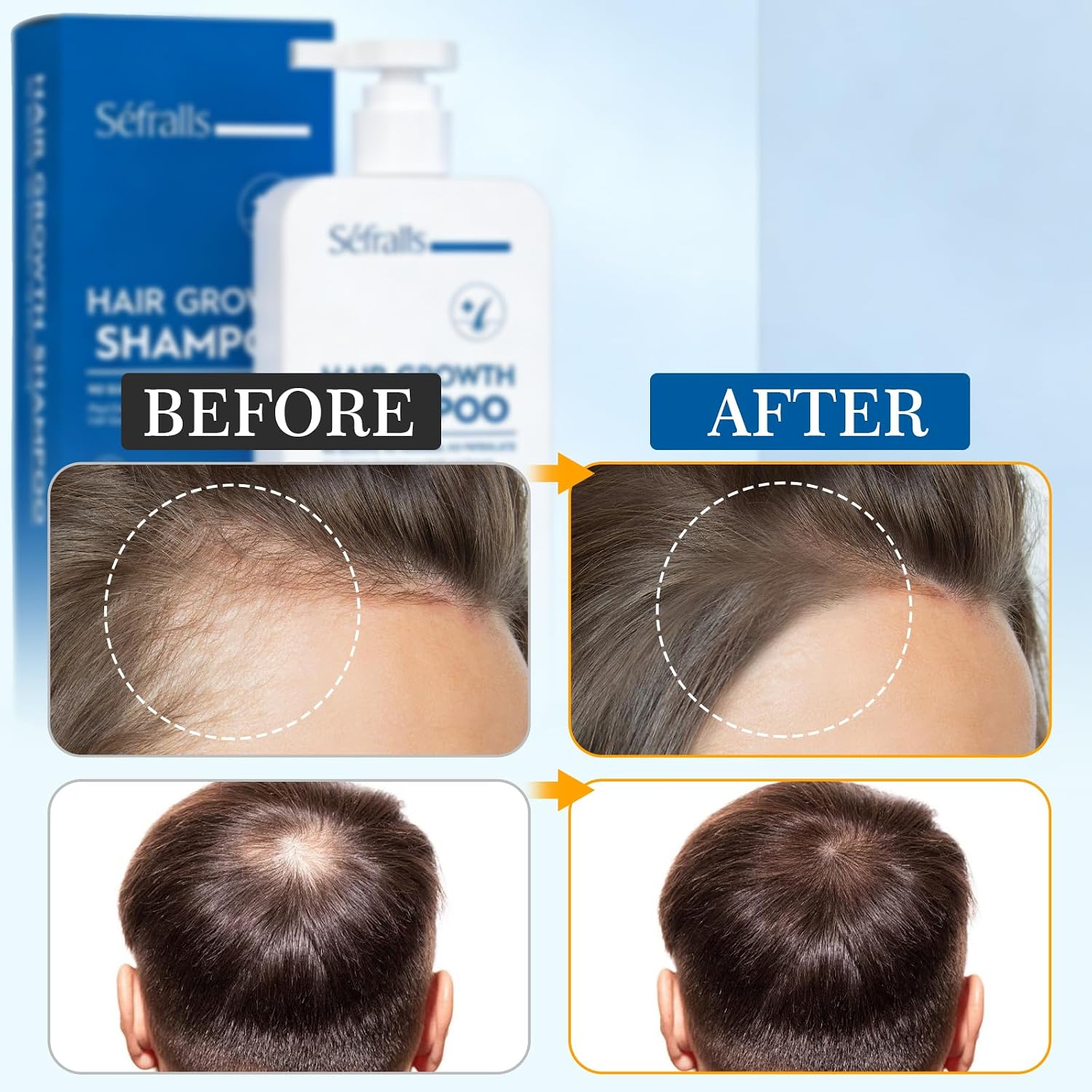 Biotin & Rosemary Shampoo for Hair Growth: Hair Loss Shampoo for Thinning Hair with Nutrient-Rich Natural Ingredients for Thicker Hair, Sulfate-Free, 10 fl oz