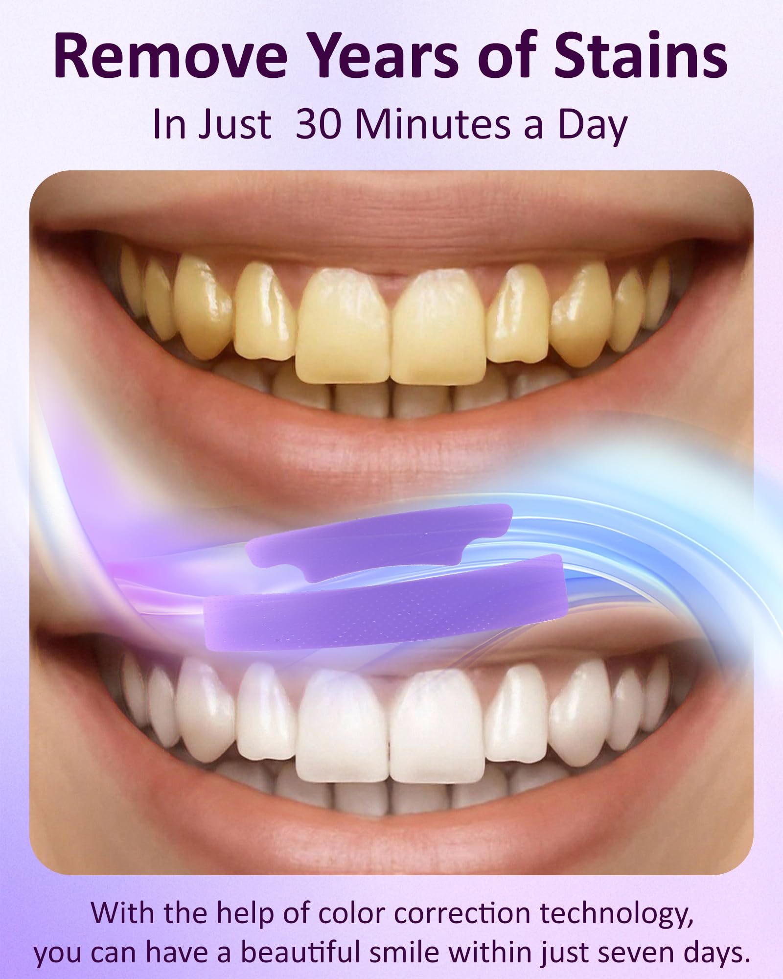 Teeth Whitening Strips, Purple Whitening Strips, Enamel Safe for Sensitive Tooth, Color Corrector, Tooth Stain Remover, Non-Slip Design, 28 Strips (14 Treatments) — view 3
