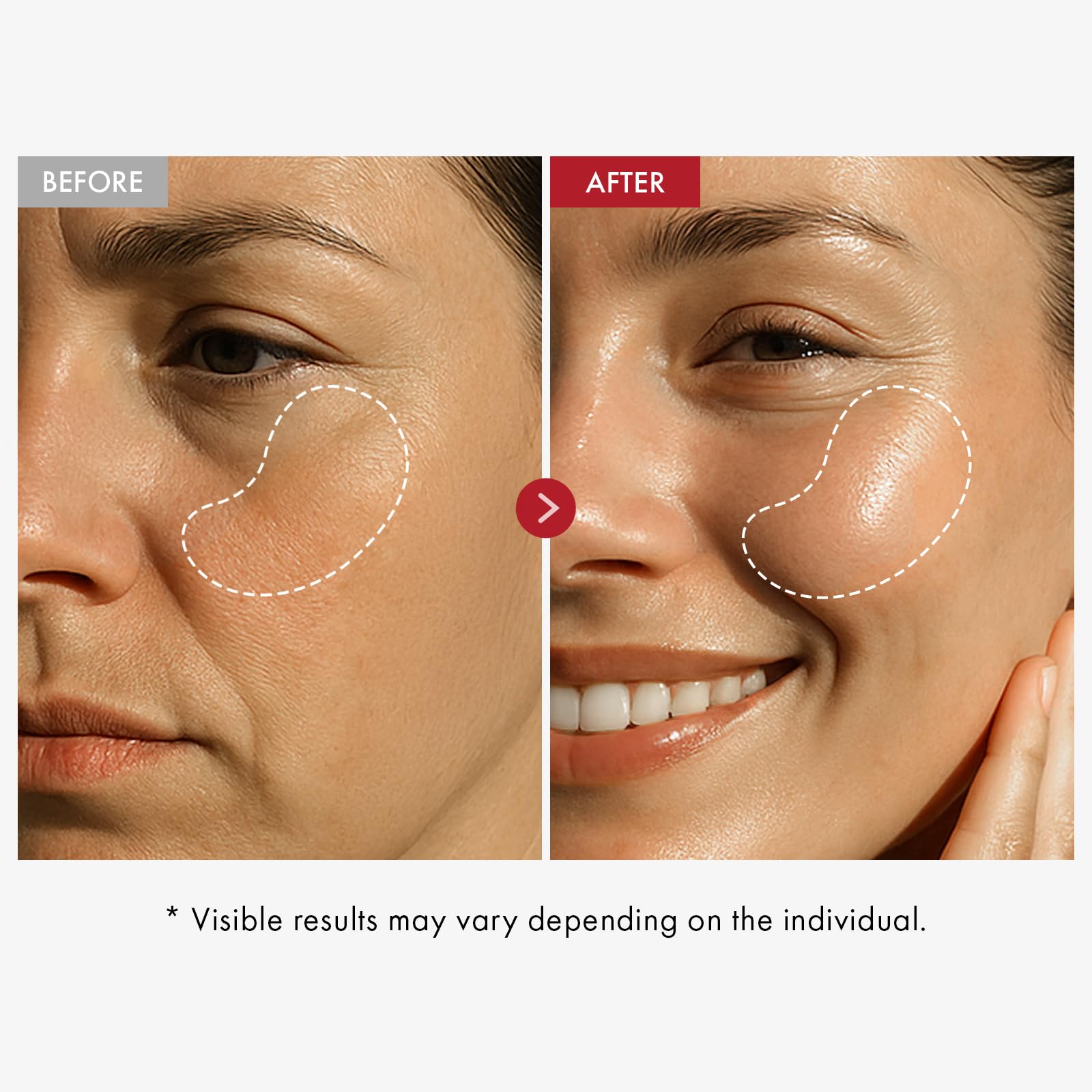 TOSOWOONG Duo Éclat et Fermeté : Sérum Niacinamide 10% Acide Tranexamique 4% & Crème Visage Real Collagen pour une Peau Jeune et Éclatante
