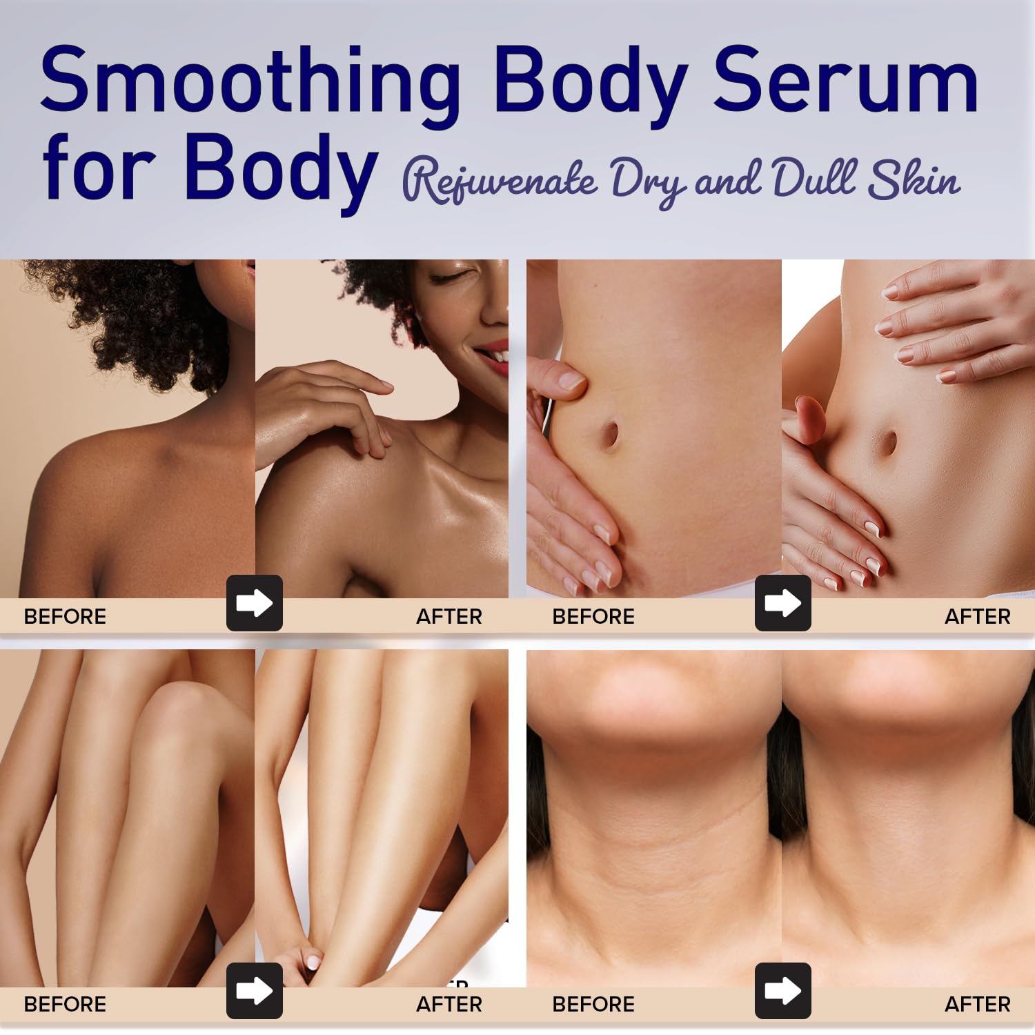 Smoothing Body Serum for Wrinkle: Body Lotion for Dry Skin | Hydrating Body Moisturizer | Daily Hyaluronic Acid Serum with Niacinamide