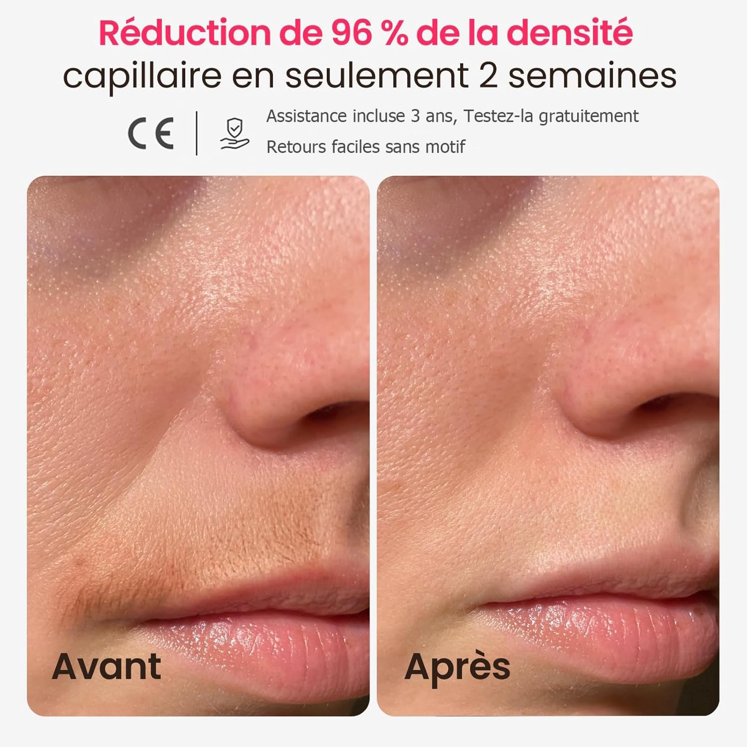 Laser IPL professionnel pour l'épilation, super rapide TRIPLE-Pulse, 12 cm² large indolore Sapphire 3℃ Ice-Cooling Contact, appareil d'épilation pour les femmes et les hommes à la maison