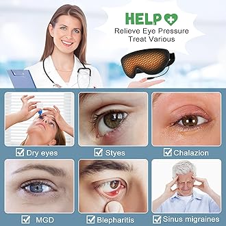Heated Eye Mask for Dry Eyes, USB Electric Warm Eye Compress Heat Eye Masks with Temperature&Timer Control, Eye Heating Pad for Dry Eyes, Stye Treatment, Chalazion, Blepharitis, MGD, Puffy
