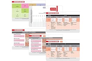 ECG Calipers for Nurses: The Ultimate EKG Cheat Sheet Set