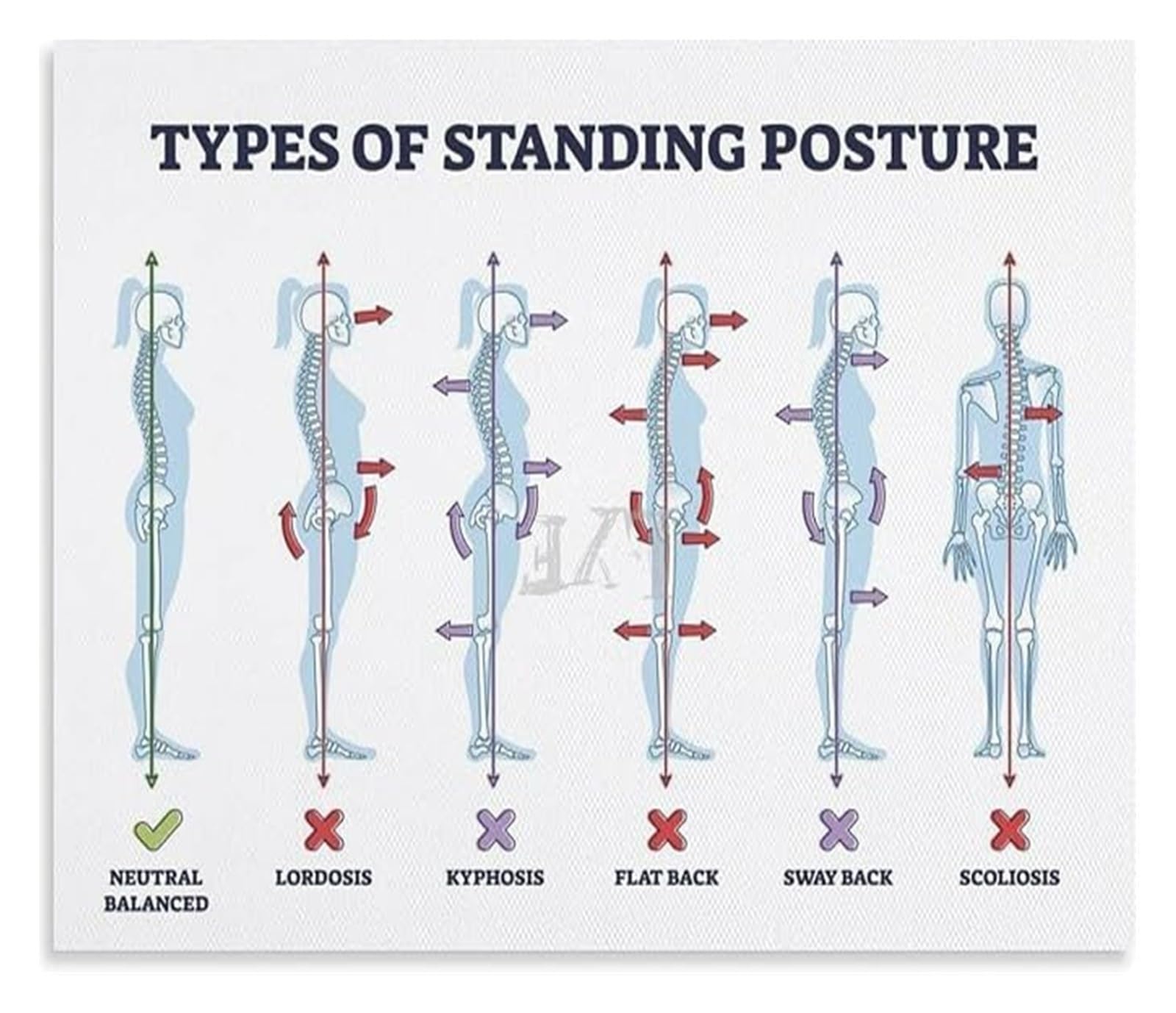 PKNVKZIDK Standing Posture Mistakes and Spine Disorders Poster Ergonomic Tips for Desk Workers Home Office Decor