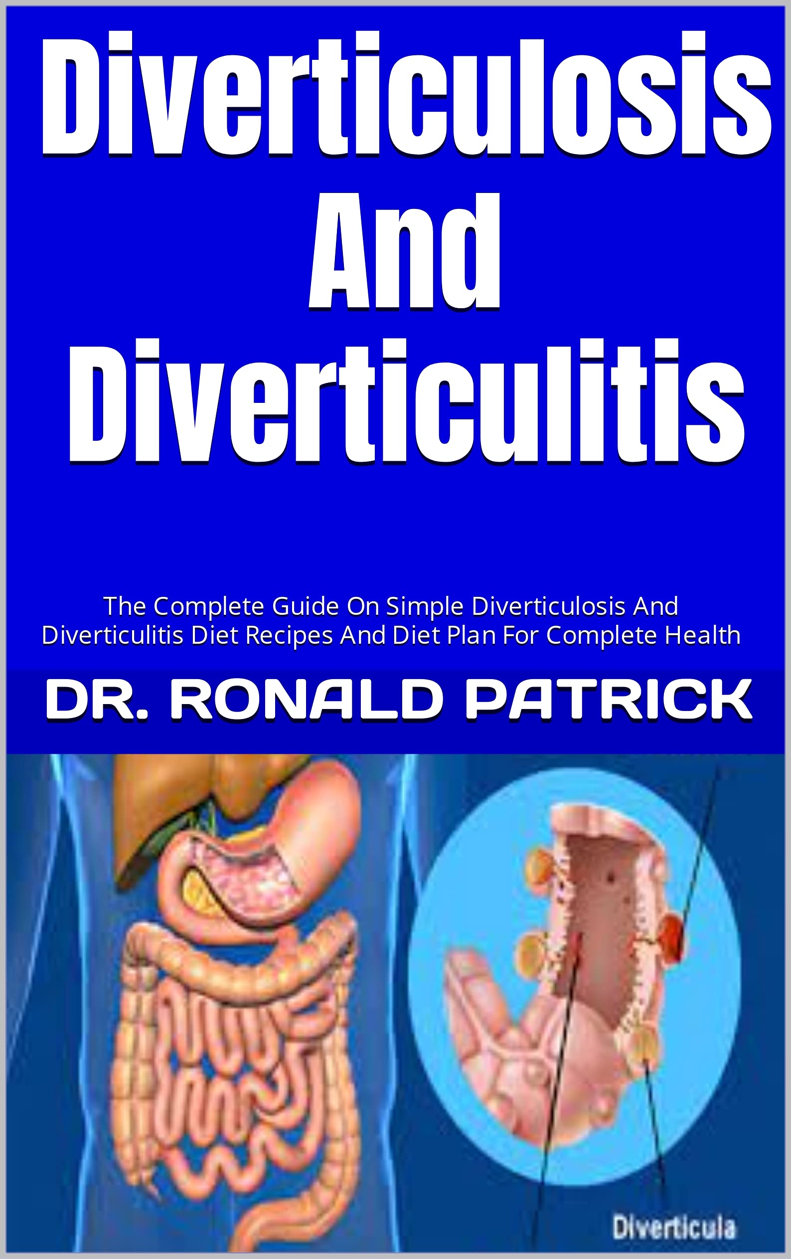 Diverticulosis And Diverticulitis : The Complete Guide On Simple Diverticulosis And Diverticulitis Diet Recipes And Diet Plan For Complete Health