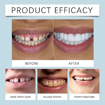 1 Pair Adjustable Snap-On Dentures - False Teeth Top & Bottom Set,Clip in Veneers Teeth with Silicone Reline,Temporary Fake Braces & Instant Smile Repair Kit for Men/Women,Silicone Reline Denture Set