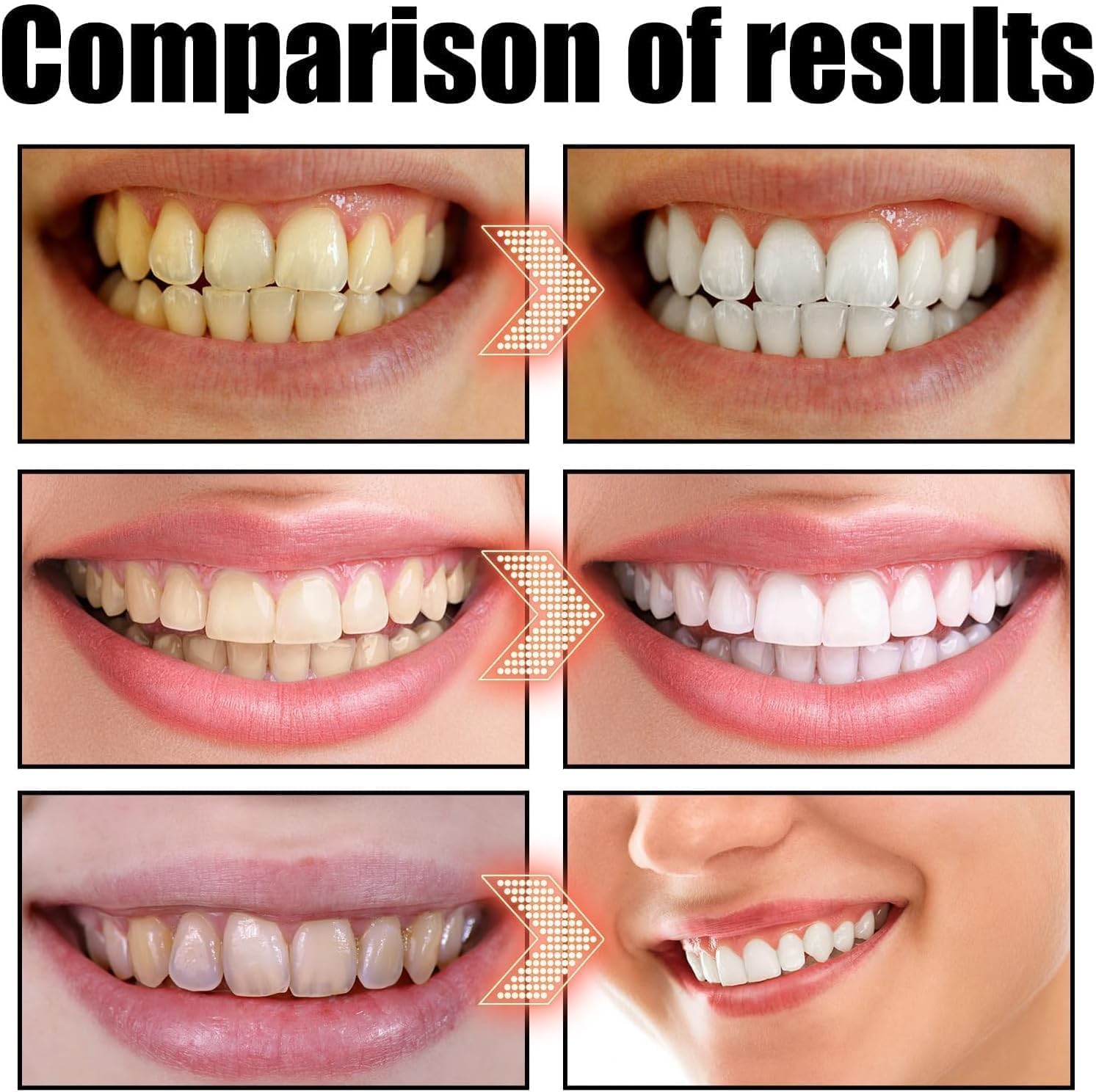 Spearmint Oil Pulling Rinse, Cold-Pressed Coconut Oil for Whitening Teeth Mouthwash, 237ML/8 FL.OZ Powerful Organic Peppermint Oil Maintain Gum Health & Oral Cleaner & Freshness Breath, Mint (1) - Image 4