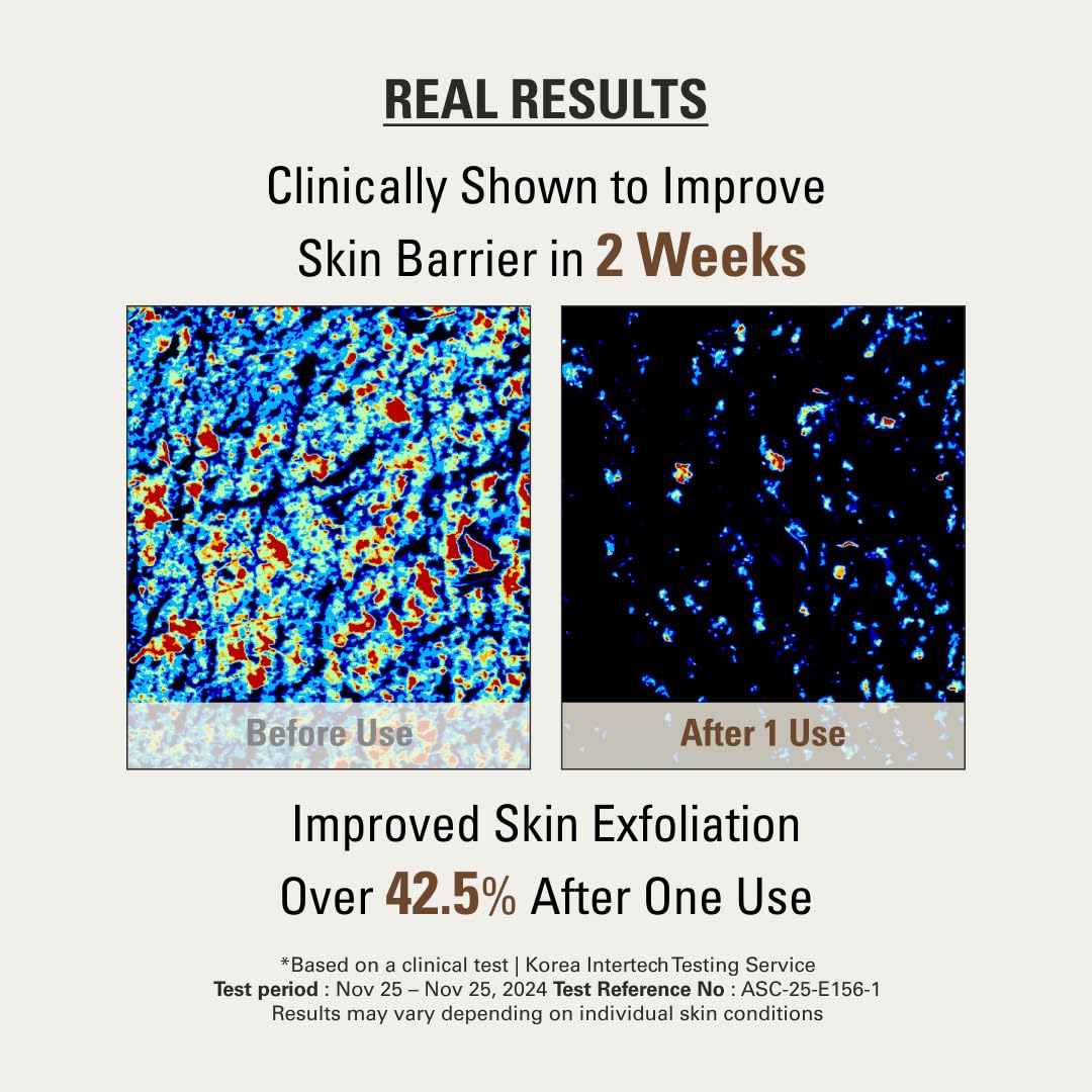 SIOT Rice Jam Mask 8.45 Ounce – Korean Icheon Rice Face & Body Mask for Deep Cleansing, Hydrating, & Radiant Skin – Natural Moisturizing & Purifying Skincare, Smooth & Soft Skin Treatment - Image 5