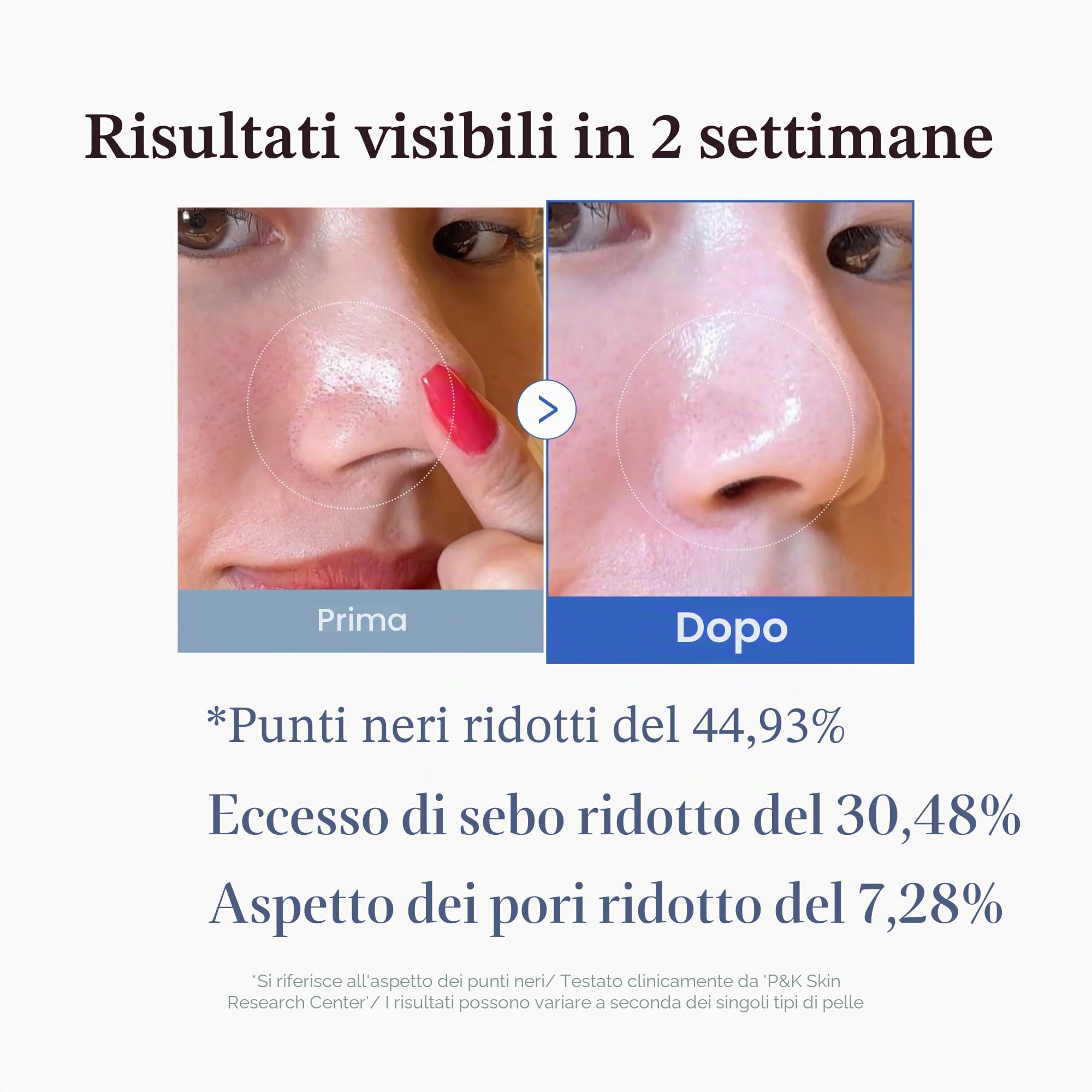 medicube Zero Pore Pads 2.0 Tamponi Tonici Per Il Viso A Doppia Texture Per L'Esfoliazione E La Cura Dei Pori Con Acido Lattico Al 4,5% E Acido Salicilico Bha Allo 0,45%, (70 Unità)