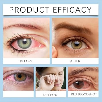 Colour Changing Eye Drops, Eye Drops for Dry Eye, Long Lasting Moisturising & Brightening Drops, Eye Fatigue Relief, Instantly Refresh and Lighten Colour (Honey)