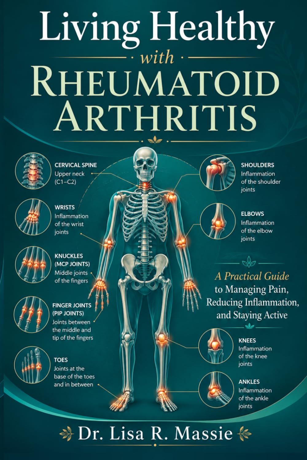 Living Healthy with Rheumatoid Arthritis: A Practical Guide to Managing Pain, Reducing Inflammation, and Staying Active