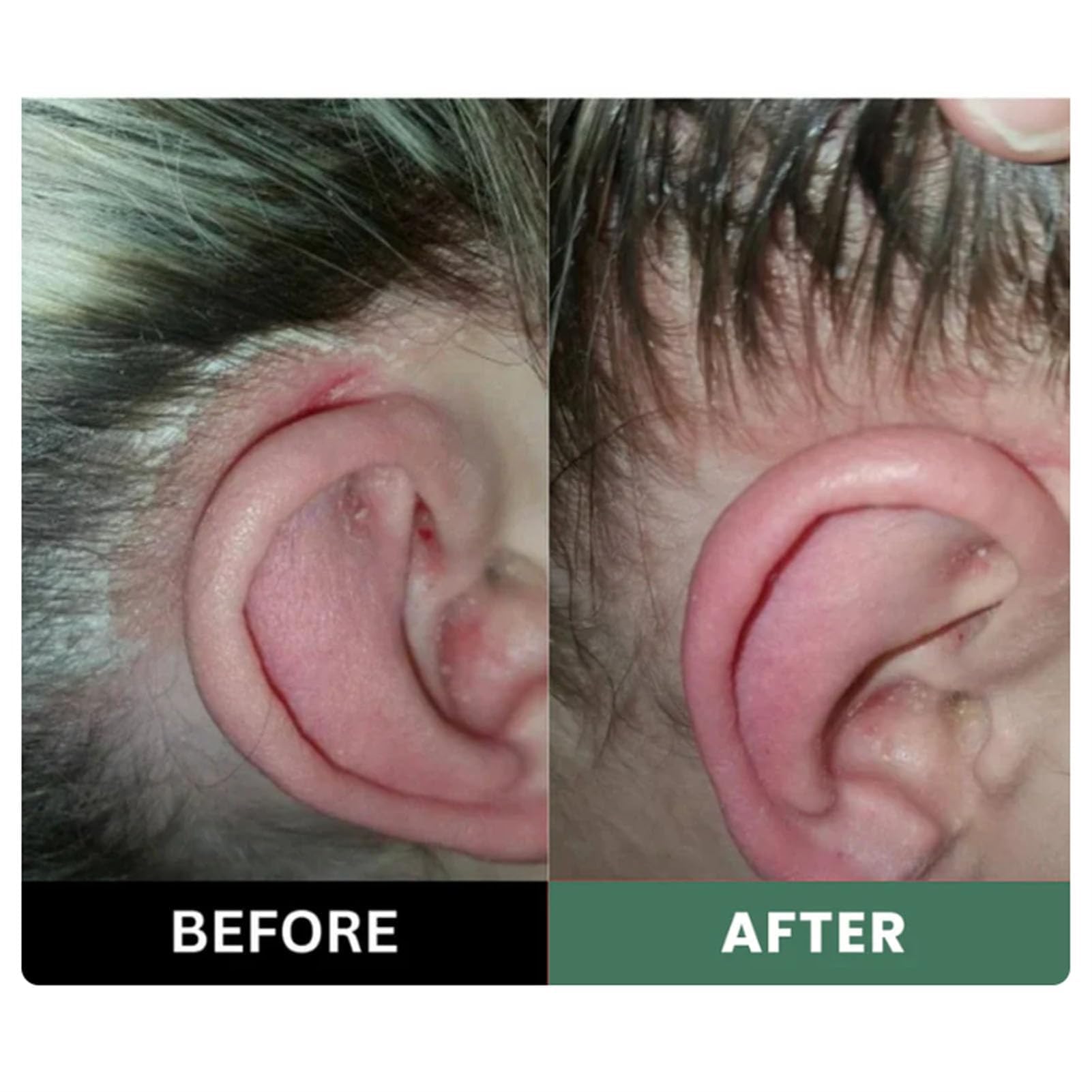 Exfoliante Natural para el Cuero Cabelludo: Limpieza Profunda, Nutrición, Hidratación y Comodidad. Alivia la Sequedad en Todo Tipo de Cabello.