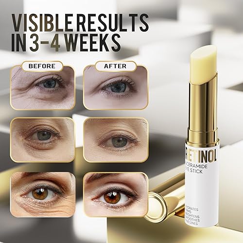 Miniatura 4 de Retinol Eye Stick, crema de ojos para ojeras e hinchazón, crema iluminadora de ojos para hidratación, arrugas en 3-4 semanas, portabilidad de viaje,