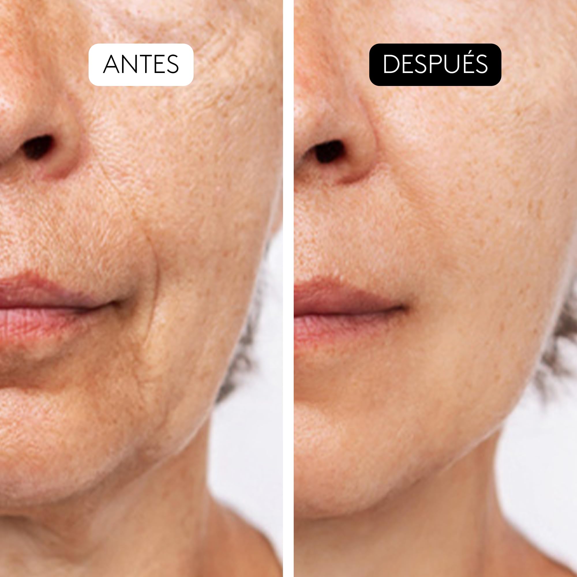 COCUNAT Triple Sérum Exfoliante AHA COMPLEX 10% Peeling Antiedad 30ml | Peeling facial diario con Ácidos Glicólico, Mandélico y Láctico. Renueva la piel y reduce arrugas y manchas.