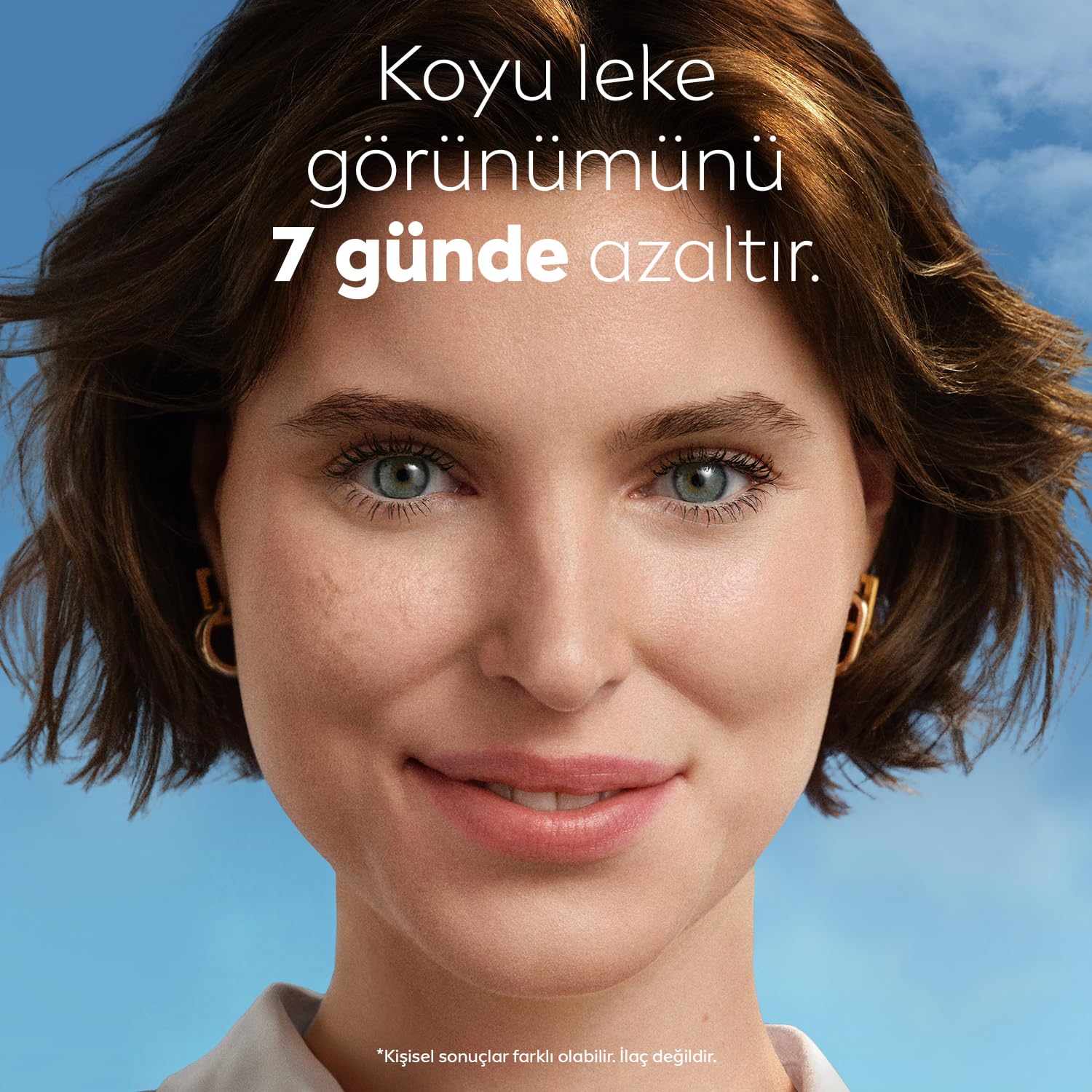 NIVEA Luminous630 Thiamidol Etkili Leke Karşıtı Cilt Serumu 30ml, Hyaluronik Asit, Cilt Tonu Eşitleyici,Aydınlık Görünüm